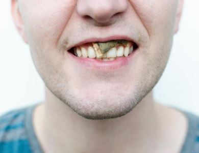 6 hacks nojentos que você faz mas não admite 6 hacks nojentos que você faz mas não admite