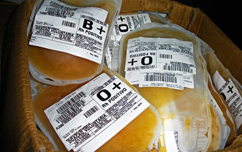 Resultado de imagem para imagens do plasma sanguineo humano