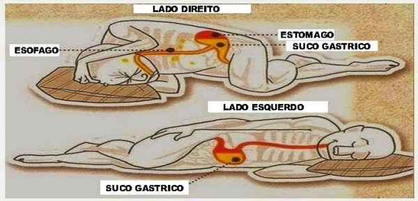 DORMIR-