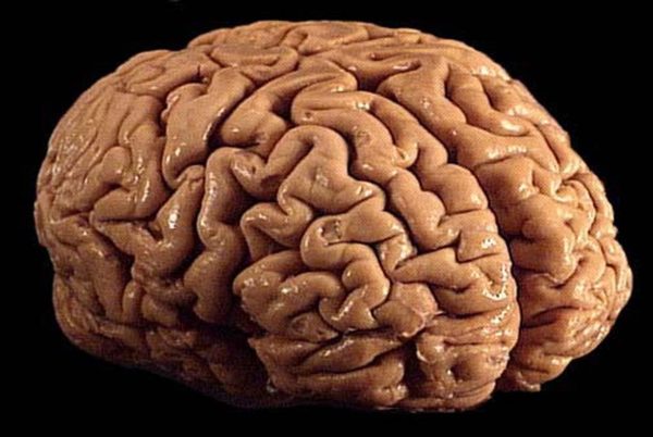 cerebro