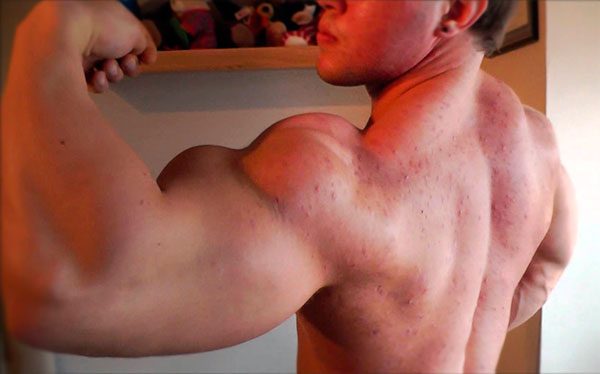 Whey Protein dá espinha