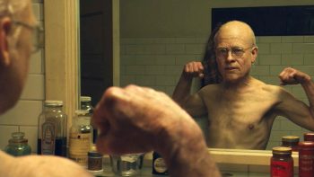 Doenças que se parecem com “O curioso caso de Benjamin Button”