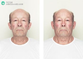 Os dois lados do seu rosto são iguais?