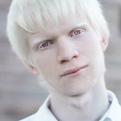 aLBINO 2