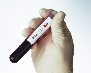 10 verdades sobre a AIDs que ninguém vai te contar
