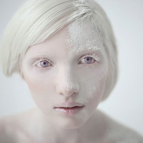 albino 1