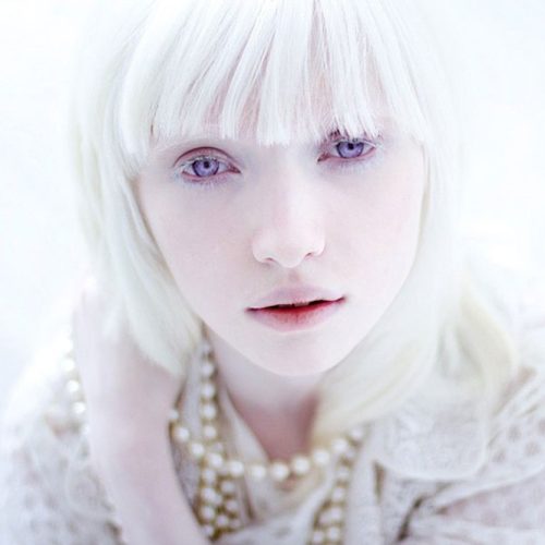 albino 16