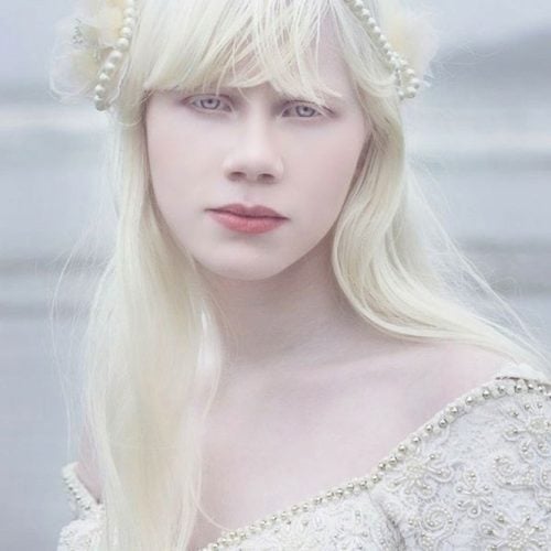 albino 9