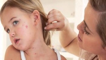 5 alergias estranhas que o ser humano pode ter