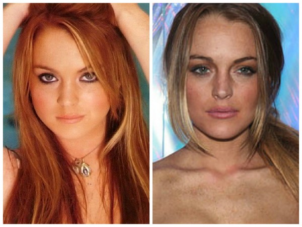 lindsay-lohan-before-and-after-photo