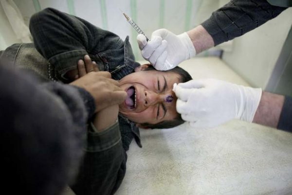 KABUL, AFGHANISTAN - OCTOBER 26: A leishmaniasis patient cries while getting a painful injection of Sodium Stibogluconate at a free specialized clinic for Leishmaniasis supported by World Health Organization (WHO) October 26, 2010 in Kabul, Afghanistan. Leishmaniasis is a disease caused by a parasite transmitted by a tiny sandfly that can lead to severe scarring, often on the face. Leishmaniasis plagues Afghanistan's poor, who often sleep on the floor, and the disease isn't a priority for the government and its aid donors who are grappling with infant mortality, tuberculosis, malaria and trauma. The most common form of the disease is not fatal, but causes untold misery and scarring on faces, stigmatizing children who are excluded at school and making it hard for girls to find husbands. According to WHO, there were an estimated 65,000 reported cases from the 2009. (Photo by Paula Bronstein/Getty Images)