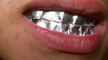 Por que os dentes levam choques quando mordemos papel alumínio?