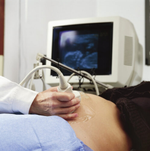 Obstetric sonography with research on monitor Pregnant woman undergoing ultrasound scan test