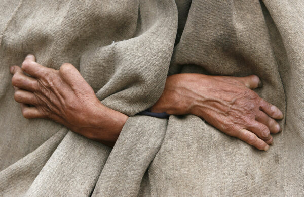 The hands of Ren'er Futie, a 70-year-old leper from the Yi ethnic minority, are pictured as he stands outside his house in Dayingpan Village in Yuexi County, Sichuan province December 15, 2007. Dayingpan Village, known by locals in the surrounding area as "ghost village", used to be the place of exile for lepers, and is now home to around 80 families, including 105 residents still suffering from the disease, local media reported. Picture taken December 15, 2007. REUTERS/Joe Chan (CHINA) - RTX4V4J