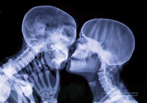 Resultado de imagem para PARTES DO CORPO HUMANO NO RX