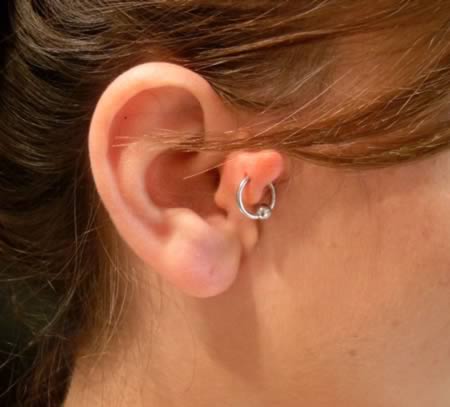 7 Marcas De Nascença Mais Raras E Bizarras Que Existem Fatos