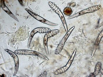 Demodex: o ácaro parasita que vive no seu rosto