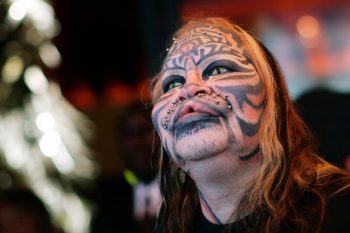 7 cirurgias plásticas mais estranhas do mundo