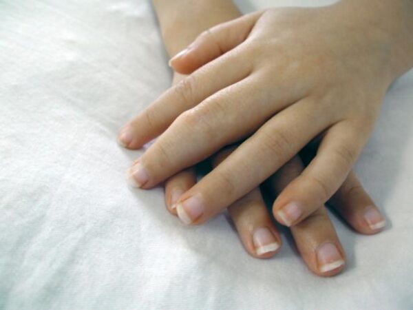 tratar-artrite-nos-dedos-das-maos3