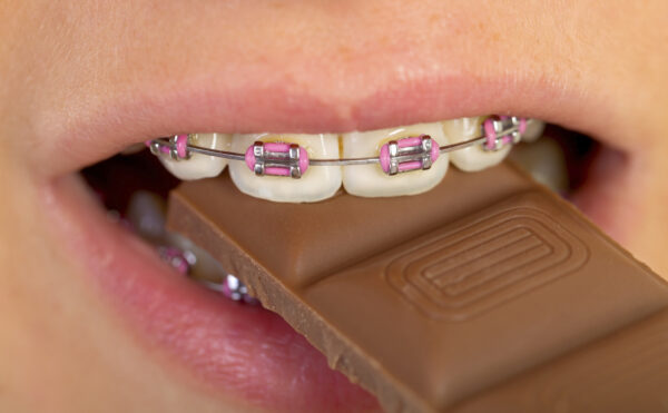 Girl with pink braces eating a chocolate