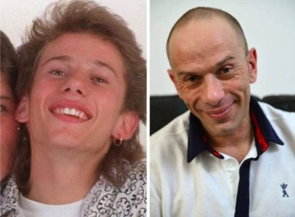 8 celebridades antes e depois das drogas 8 celebridades antes e depois das drogas