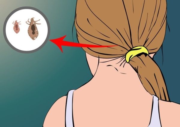728px-Prevent-Lice-Step-1