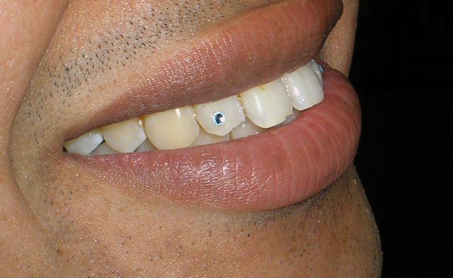 7 sinais que você é extremamente brega e nunca reparou