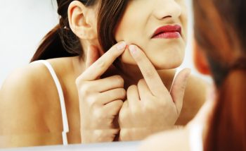 10 coisas que só quem teve ou tem muitas espinhas vai entender