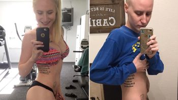 Atleta mostra efeitos do câncer de ovário e emociona o mundo