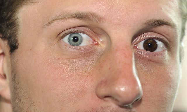 9 características extremamente raras que poucos seres humanos tem ...