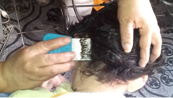 O vídeo mais extremo de piolhos que você vai ver na vida