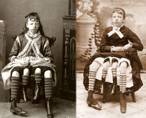 7 coisas mais obscuras que aconteciam nos “Freak shows” do passado ...