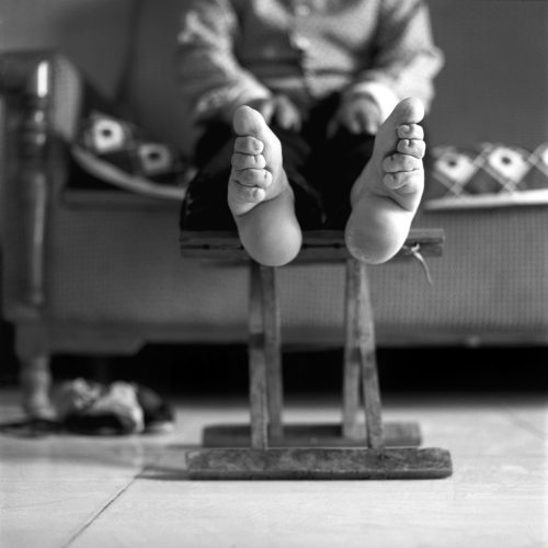 Conheça os pés de Lótus, a técnica de beleza mais dolorosa praticada na