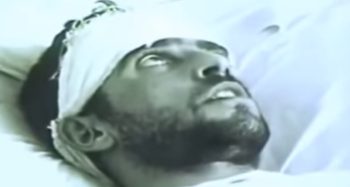 Esse vídeo terrível mostra os sintomas da raiva em humanos