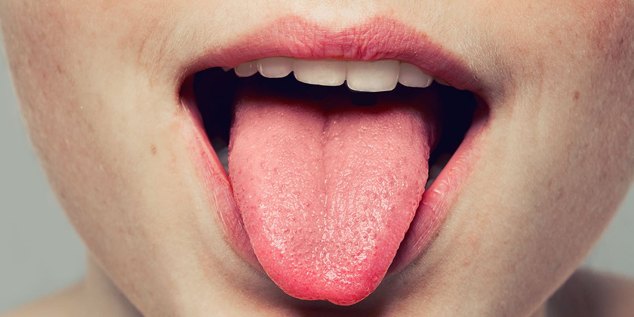 8 doenças que podem ser reveladas olhando a cor da sua língua