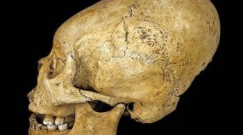 Mistério por trás dos crânios alongados é desvendado por cientistas