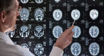 Conheça a trágica história da mulher que começou a ouvir ‘vozes divinas’ por conta de tumor no cérebro