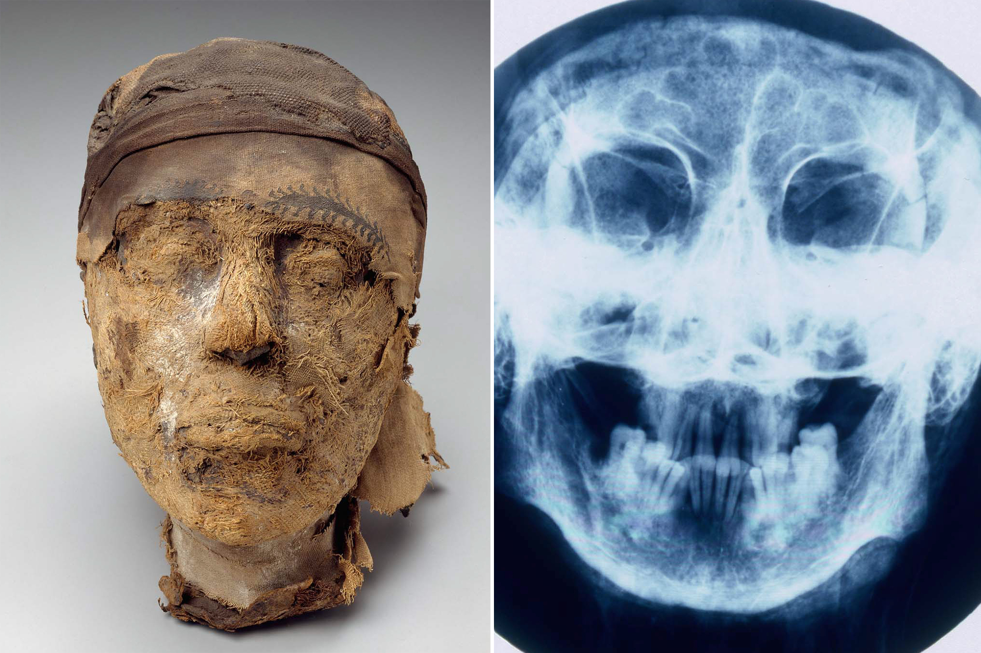 FBI ajudou a resolver mistério de cabeça de múmia com mais de 4 mil anos