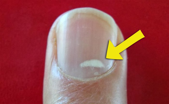 10 sinais secretos que seu corpo dá quando precisa de algo e você nunca percebeu