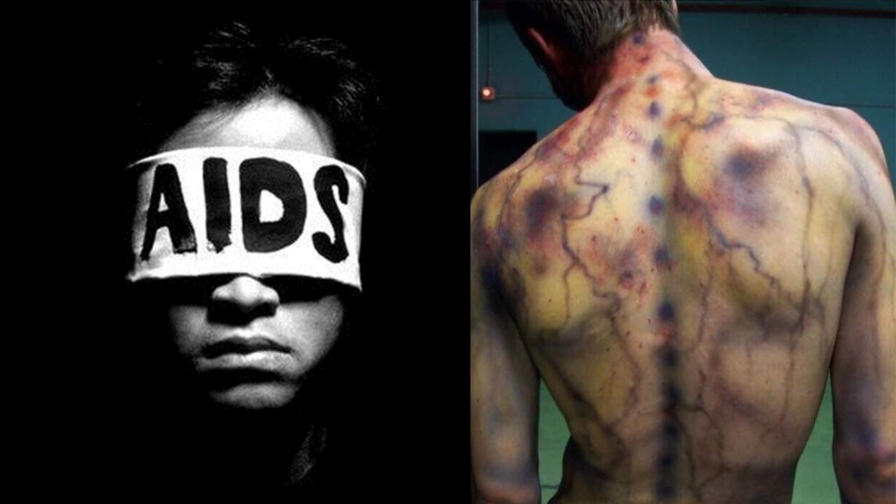 7 doenças que mais mataram seres humanos em toda a História