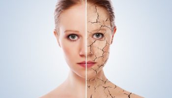 7 sinais de que seu corpo precisa de mais cálcio