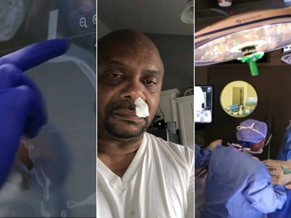Homem com nariz escorrendo descobre que vazamento é fluido cerebral
