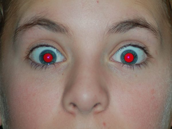 BoldRedEye 7 COISAS IRRITANTES QUE ACONTECEM E AS EXPLICAÇÕES POR TRÁS DELAS BoldRedEye