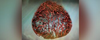 Agora é possível criar vasos sanguíneos perfeitos em laboratório