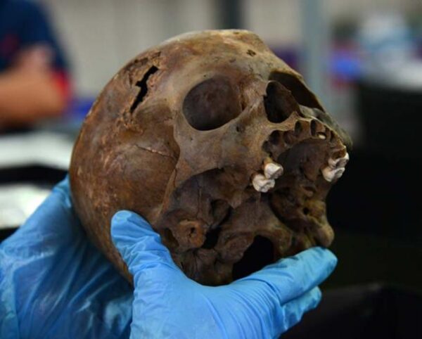 The skull of the Aztec child sacrifice 7 CIVILIZAÇÕES ANTIGAS QUE SACRIFICAVAM CRIANÇAS The skull of the Aztec child sacrifice