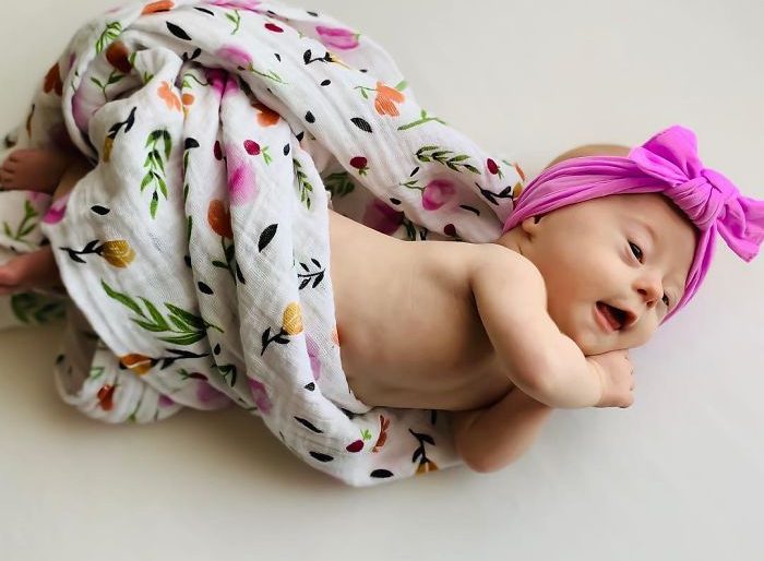 Mulher faz relato emocionante sobre como é ter um bebê com síndrome de down