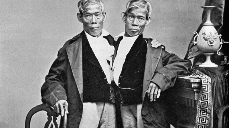 chang eng irmaos siameses 3 Chang e Eng, os irmãos siameses que fizeram suas vidas nos EUA e tiveram 21 filhos chang eng irmaos siameses 3