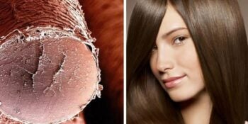 Tente acertar qual é a parte do corpo vendo apenas uma foto microscópica [Quiz]