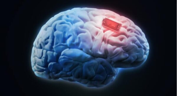c%C3%A9rebro 2 Elon Musk tem ideia de implantes mentais assustadores c%C3%A9rebro 2