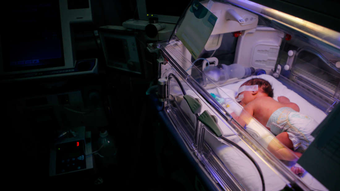 Nascer prematuramente pode afetar a personalidade, entenda
